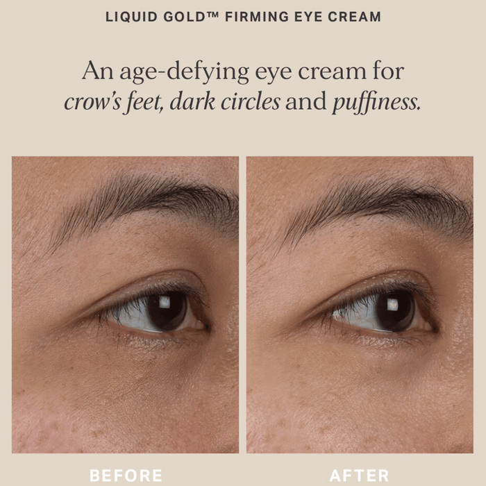 Alpha-H Liquid Gold Firming Eye Cream 15ml