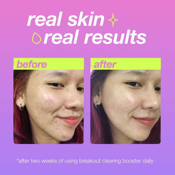 Dermalogica skin care Dermalogica Breakout Clearing Booster