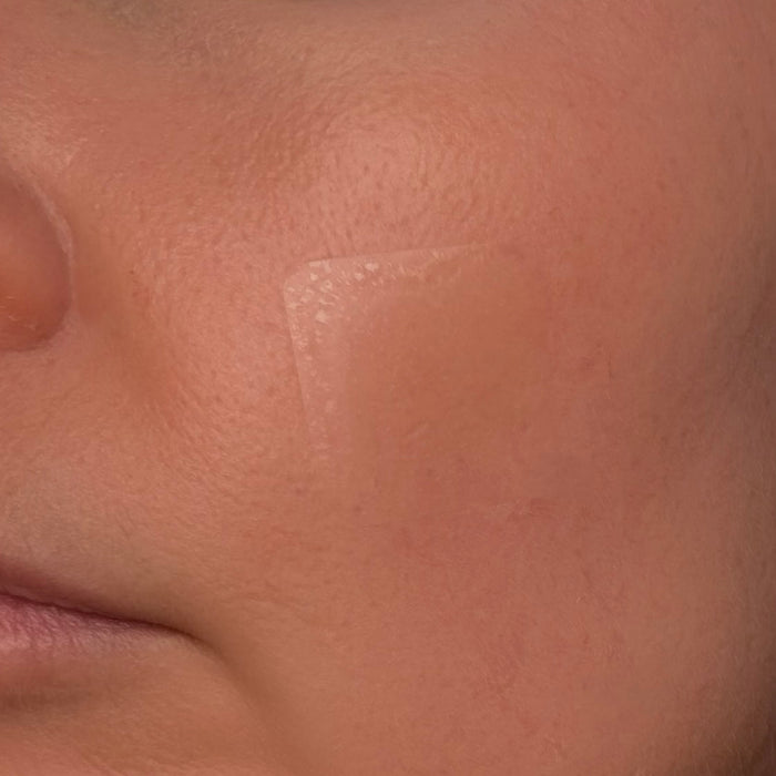 Close-up of a person's skin with a patch applied to the cheek.