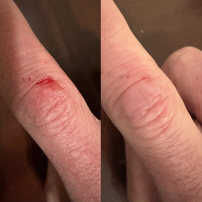 Close-up of a cut on a finger before and after healing.
